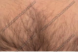 human skin hairy 0002